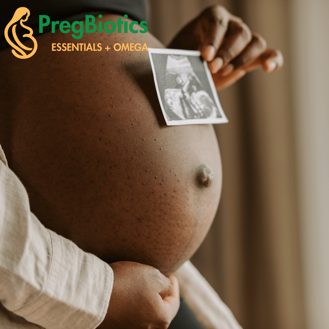 PregBiotics Essentials + Omega — image 3